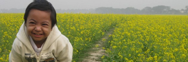 ডাউন সিনড্রোম কোন রোগ নয়